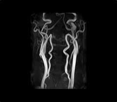 ����MRA���ʉ摜